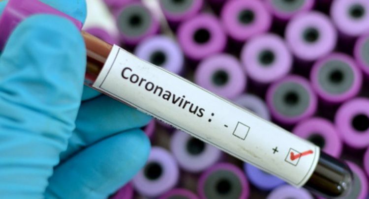 Coronavirus